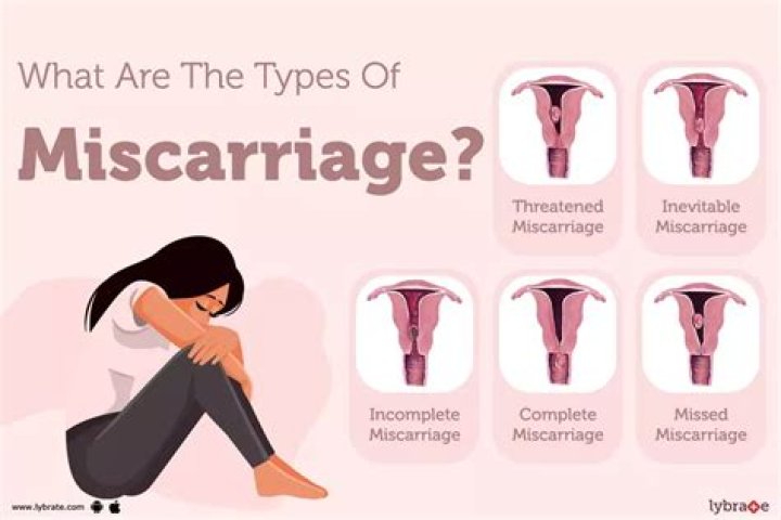 Can falling hard on your stomach cause a miscarriage?