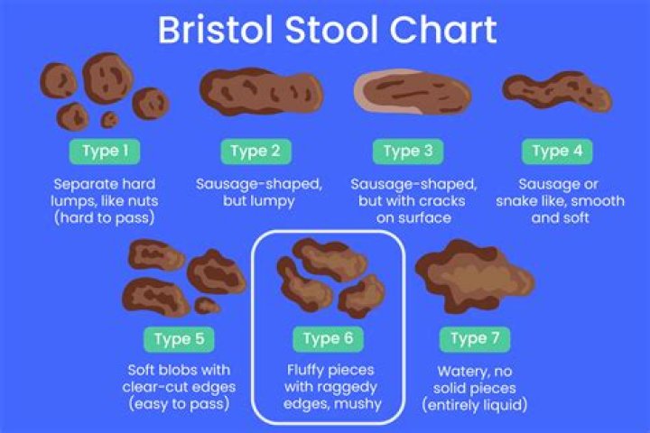 Can milk make your poop white?