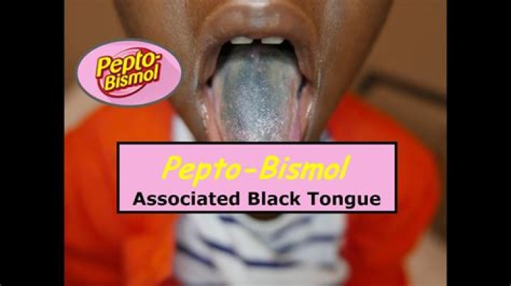 Can Pepto-Bismol make your tongue black?