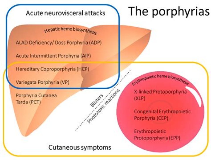 Can porphyria cause vertigo?