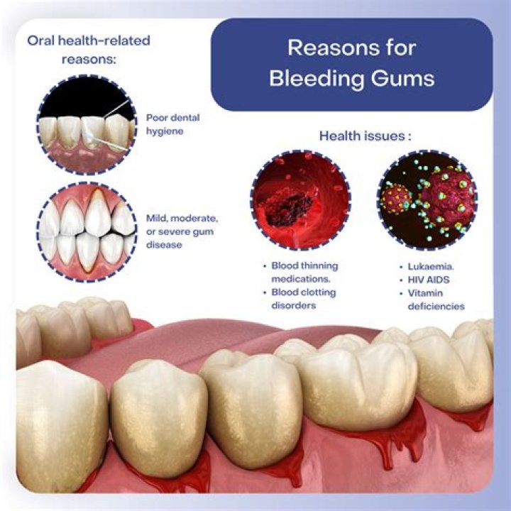 Can sensitive teeth cause bleeding?