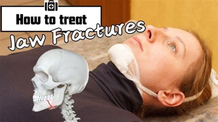 Can you fracture your jaw eating?