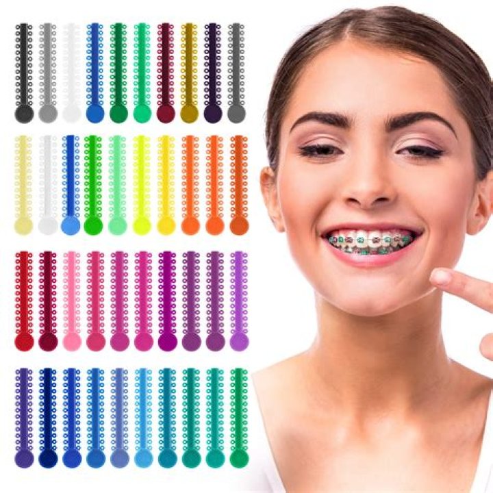 Can you pick your own color for braces?