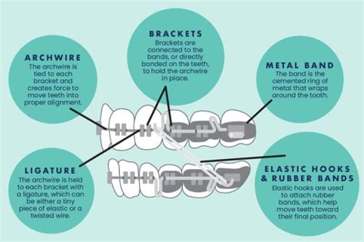 Do hip braces actually work?