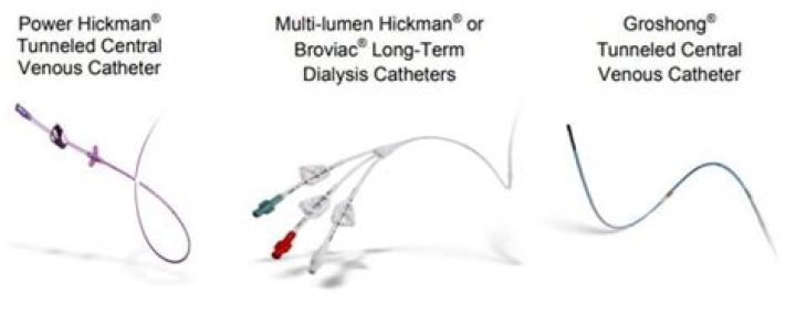 Does a tunneled catheter require a sterile dressing?