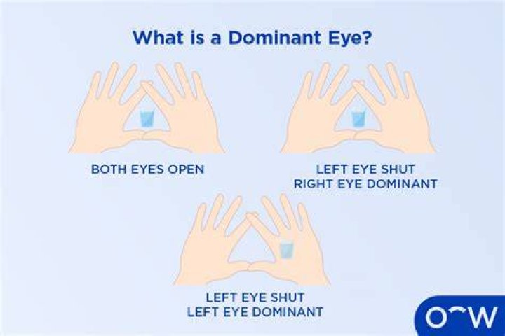Does eye dominance match hand dominance?
