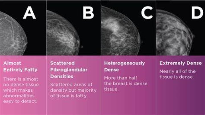 Does homogeneous mass mean cancer?