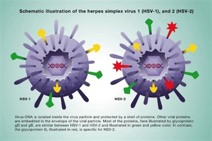 Does HSV-2 have a vaccine?