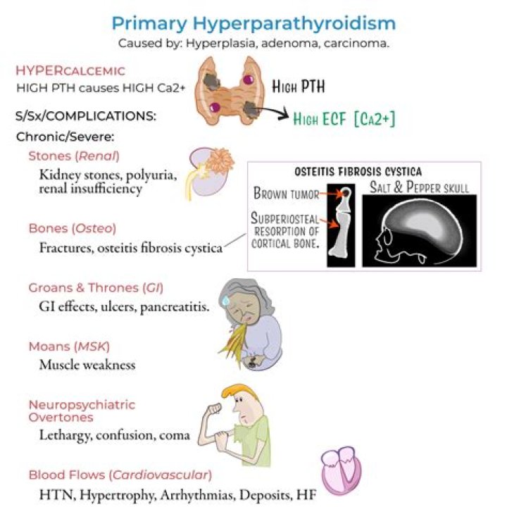 Does hyperparathyroidism cause Hyperchloremia?