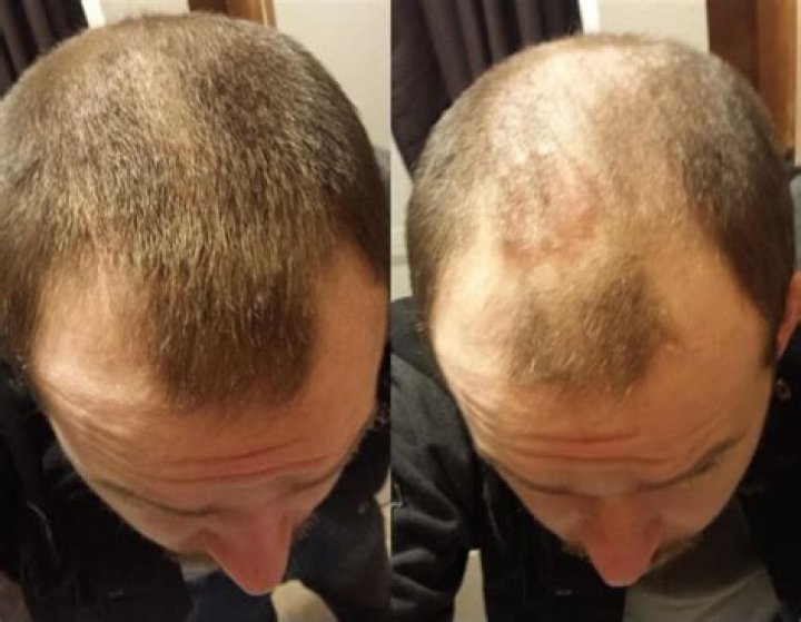 Does Toppik regrow hair?