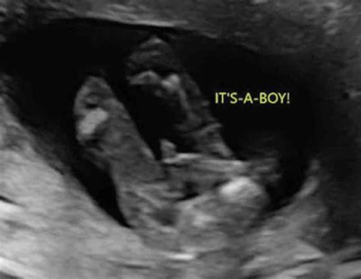 How accurate is gender scan at 30 weeks?