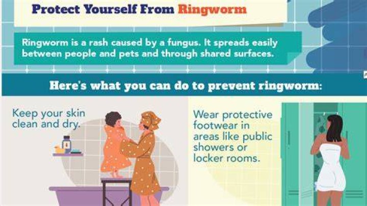 How do you cover ringworm while sleeping?
