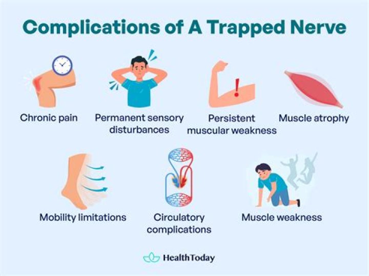 How do you treat a trapped nerve when pregnant?