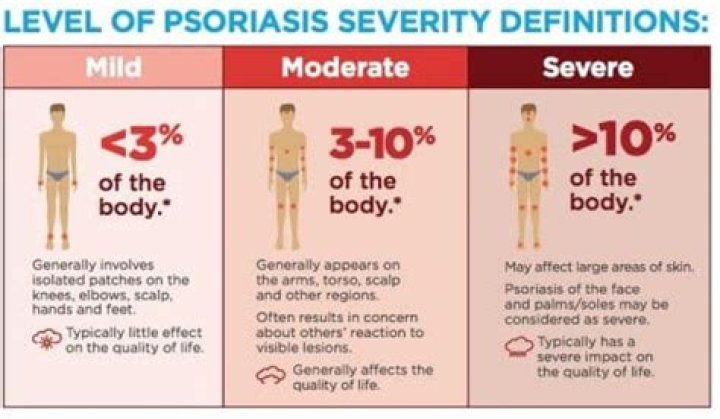 How is severity of psoriasis measured?