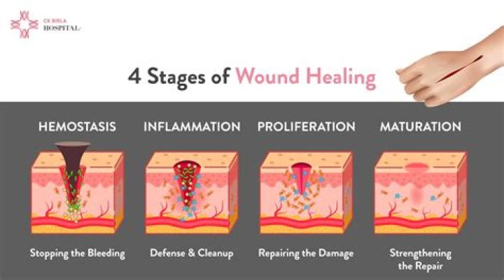 How long does it take for skin to heal from liquid nitrogen?