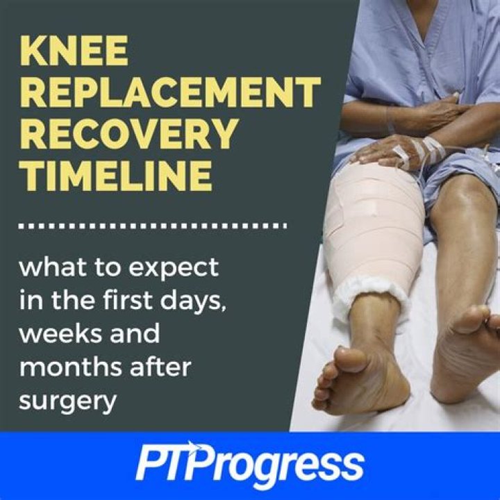 How long does it take to recover from OCD knee surgery?