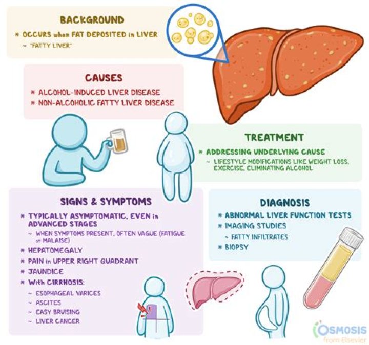 Is hepatic steatosis the same as fatty liver?