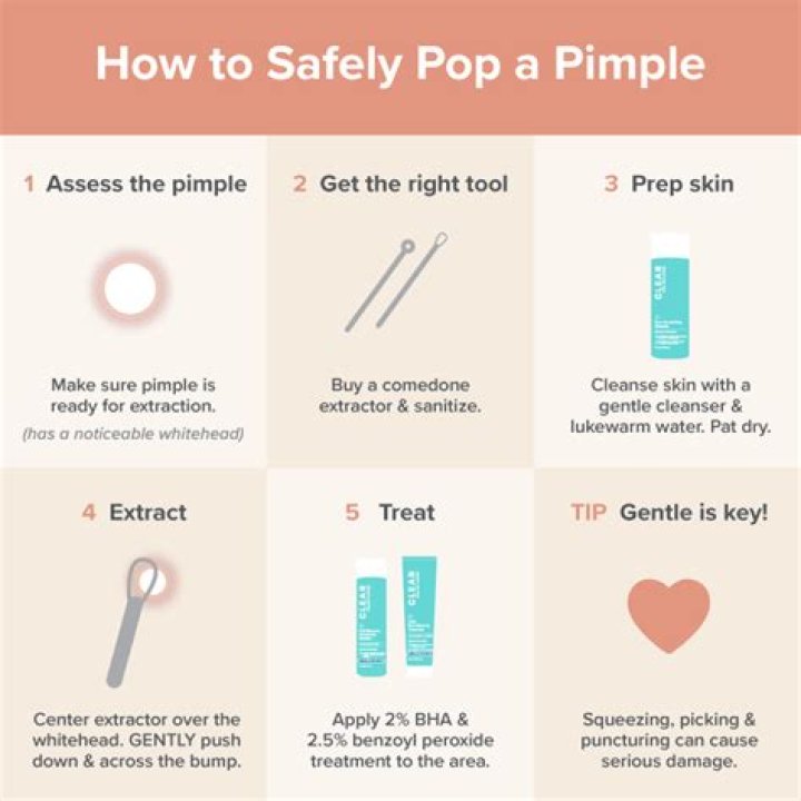 Is it bad to pop a big white head?