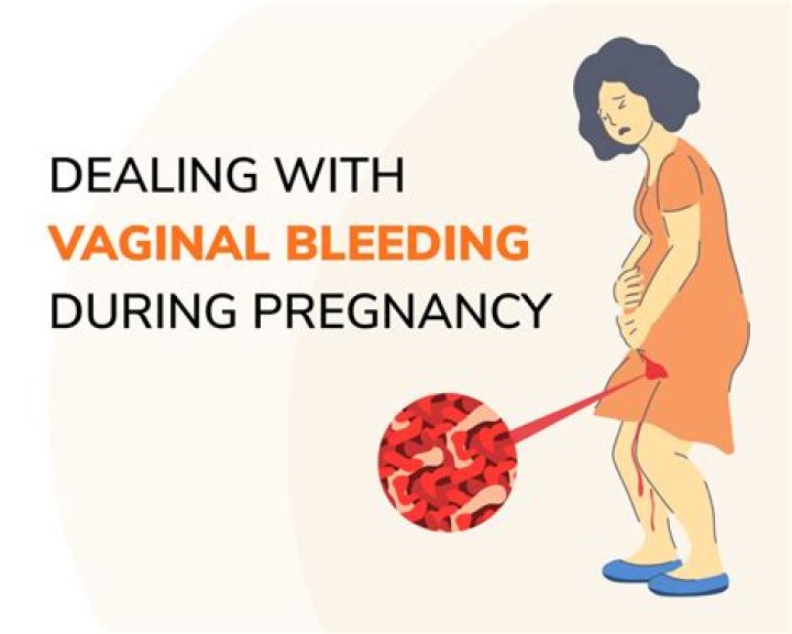 Is it safe for a pregnant woman to donate blood?