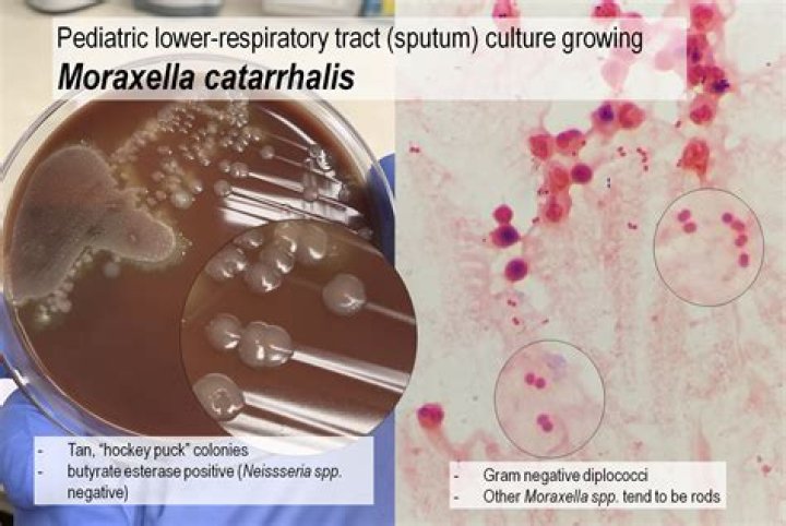 Is Moraxella catarrhalis gram positive?