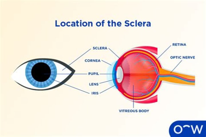 Is sclera internal or external?