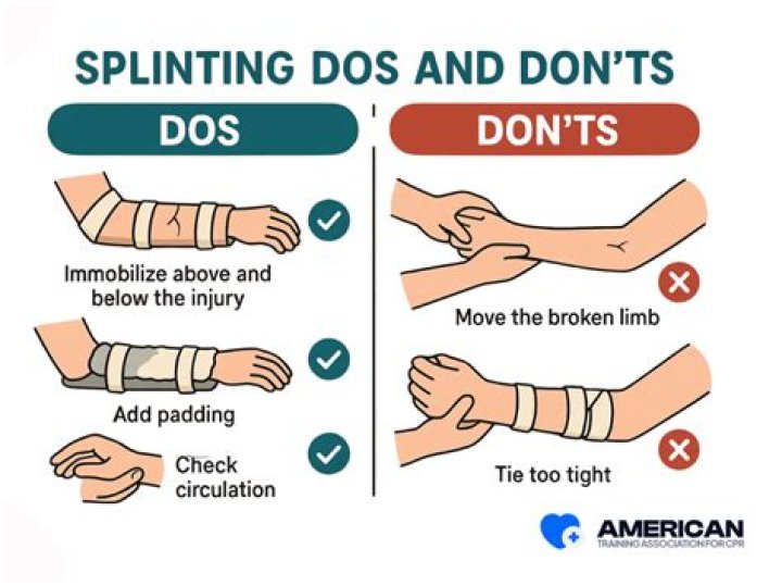 What are the 3 types of splints?