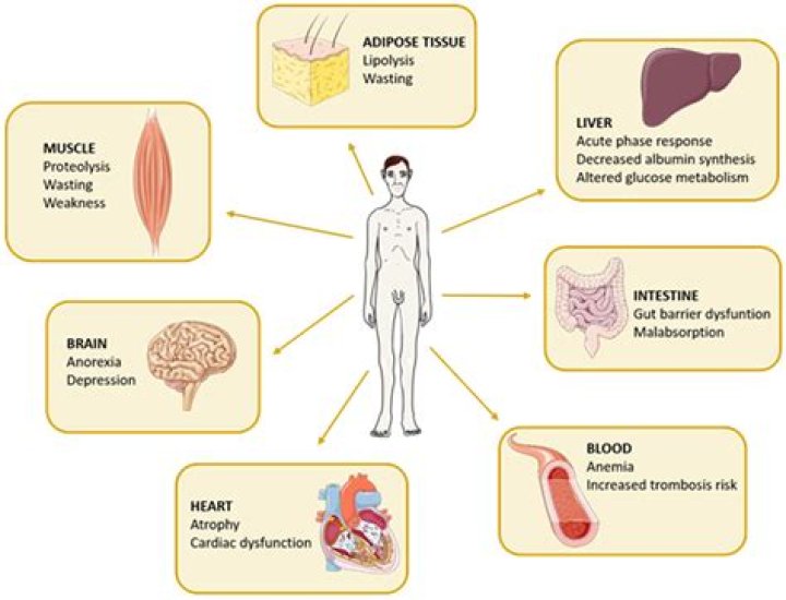 What are the causes of spermatorrhea?