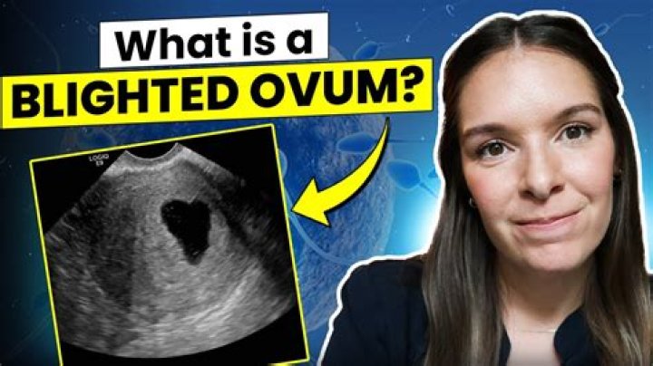 What are the chances of having a blighted ovum again?