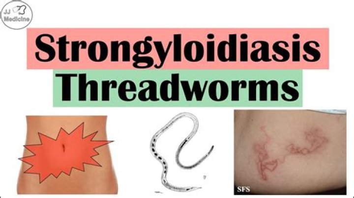 What are the symptoms of Strongyloidiasis?