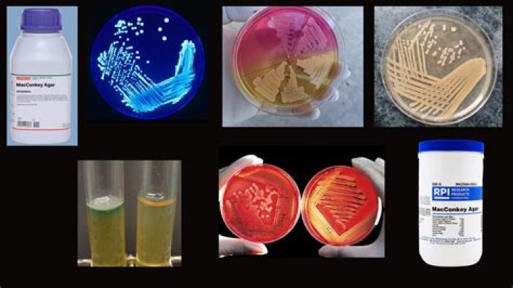 What are the three main types in terms of their physical forms of microbiological culture media quizlet?