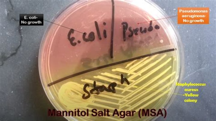 What does a positive MSA test mean?