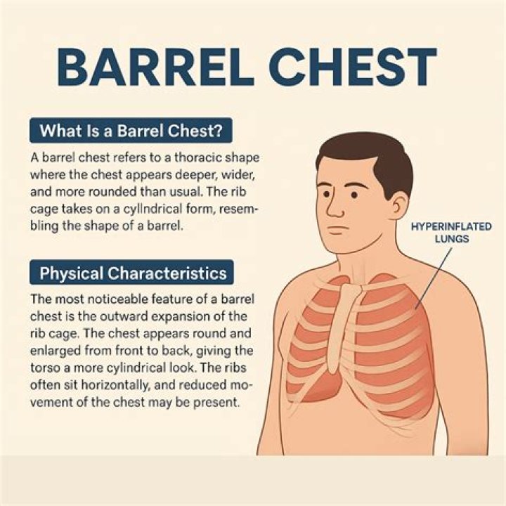 What does barrel prospect mean?