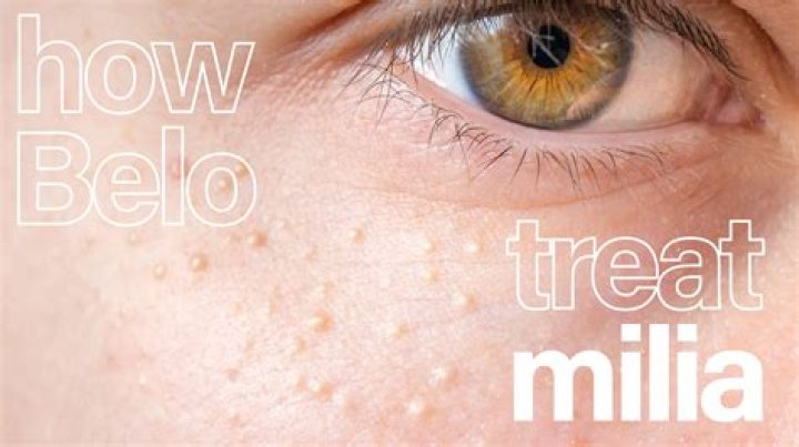 What does milya mean?