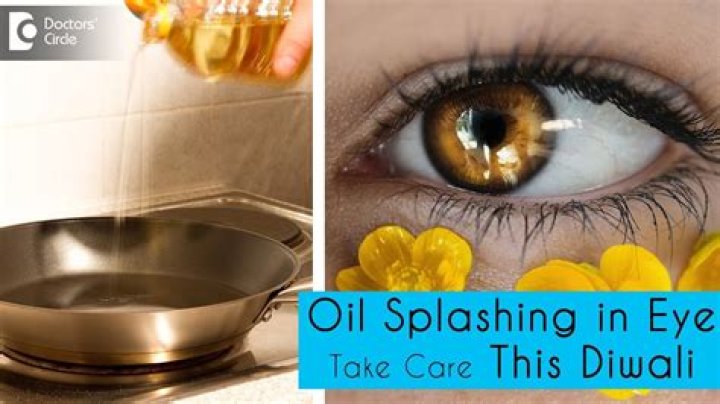 What happens if hot oil goes into eyes?