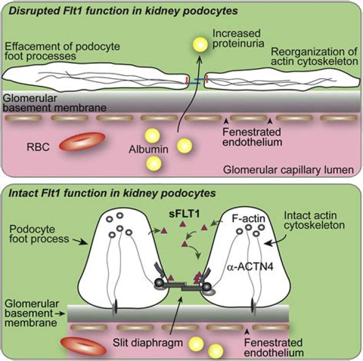 What is FLT1 gene?