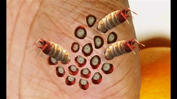 What is lotus pod cyst?
