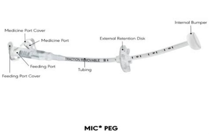What is peg bushing?