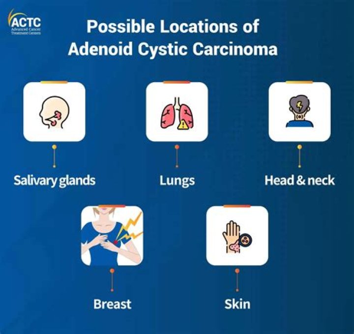 What is the cause of adenoid cystic carcinoma?