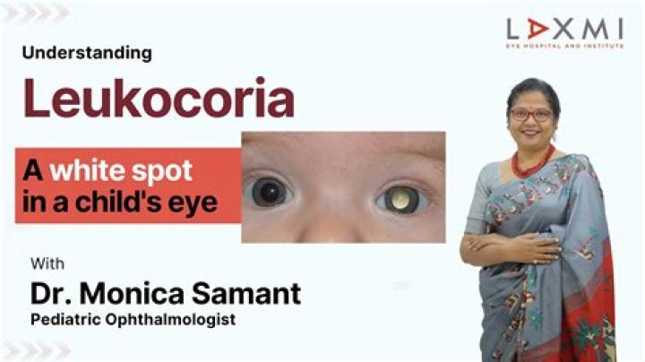 What is the most common cause of leukocoria?