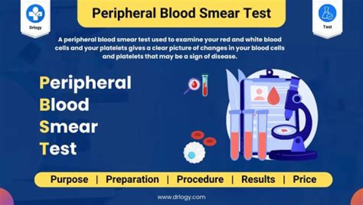 What is the most important thing to remember when creating a blood smear?