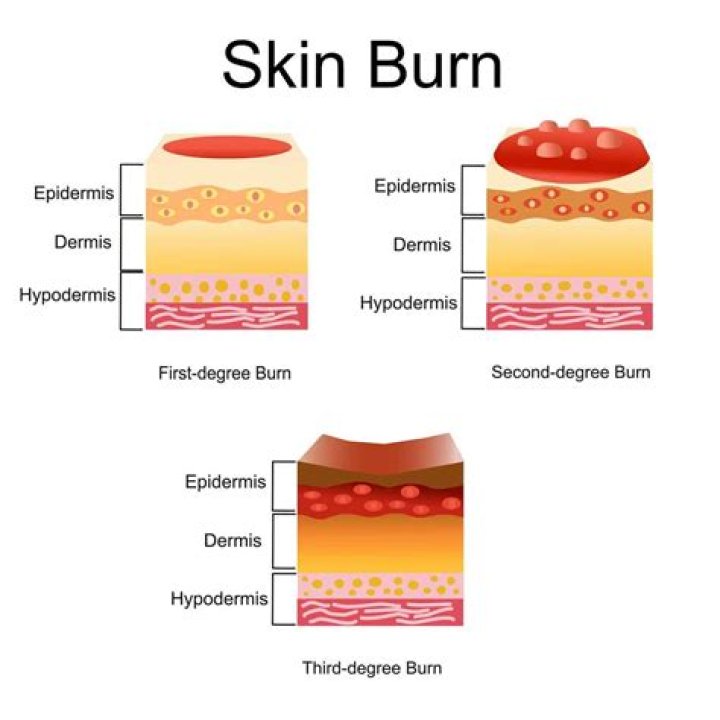 What is the saying Burn me once?