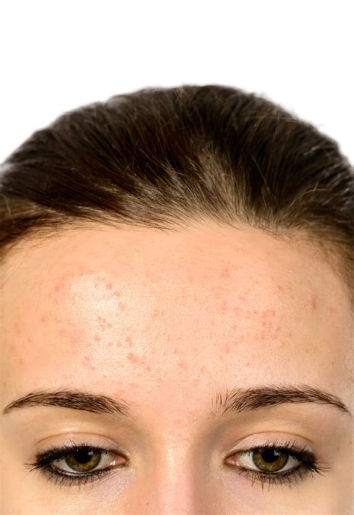 What is the texture on my face?