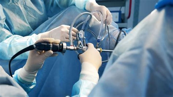 What kind of doctor does surgery for hyperhidrosis?