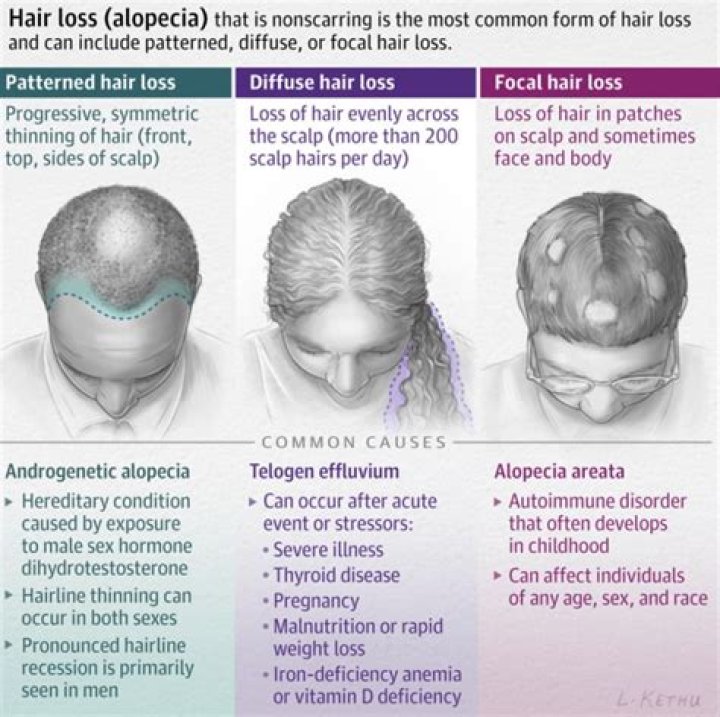 What mental illness causes baldness?