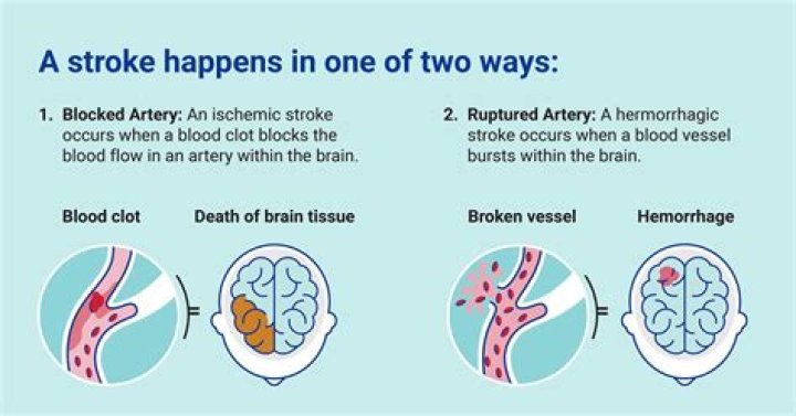 What to do if you shoot into an artery?