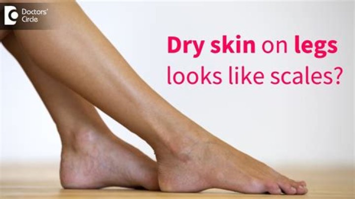 Why does the skin on my lower legs feel tight?